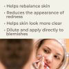Zit Fighter Synergy Essential Oil 10 mL